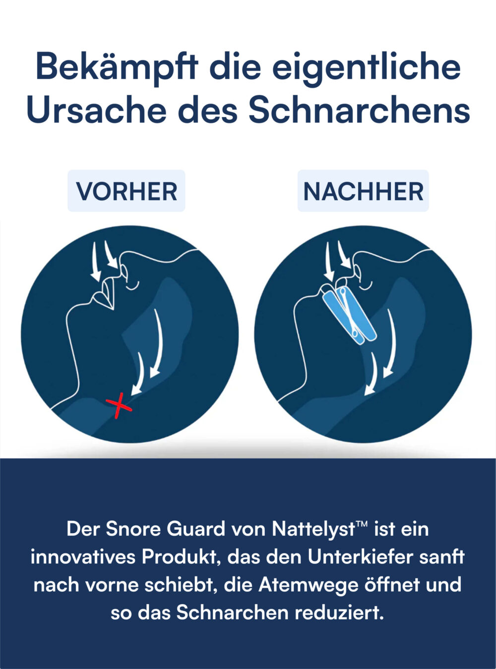 Anti-Schnarch-Paket